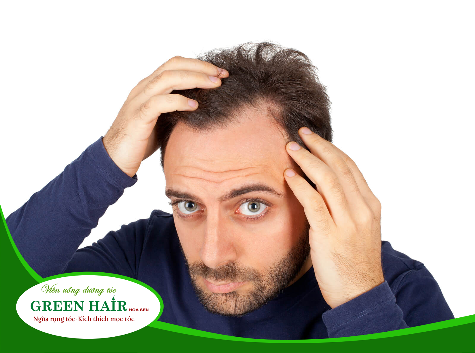 Hiện tượng rụng tóc ở nam giới thường xuất hiện ở tuổi 30